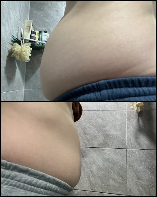 뱃살변화